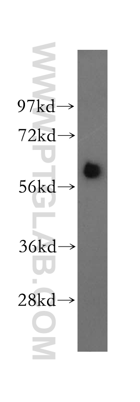 WB analysis of HeLa using 12447-1-AP