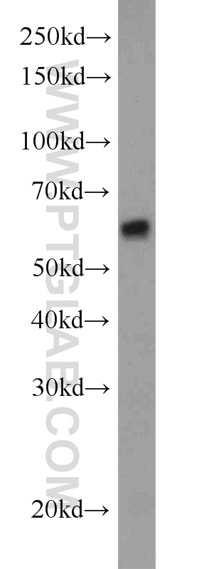 WB analysis of A549 using 11321-1-AP