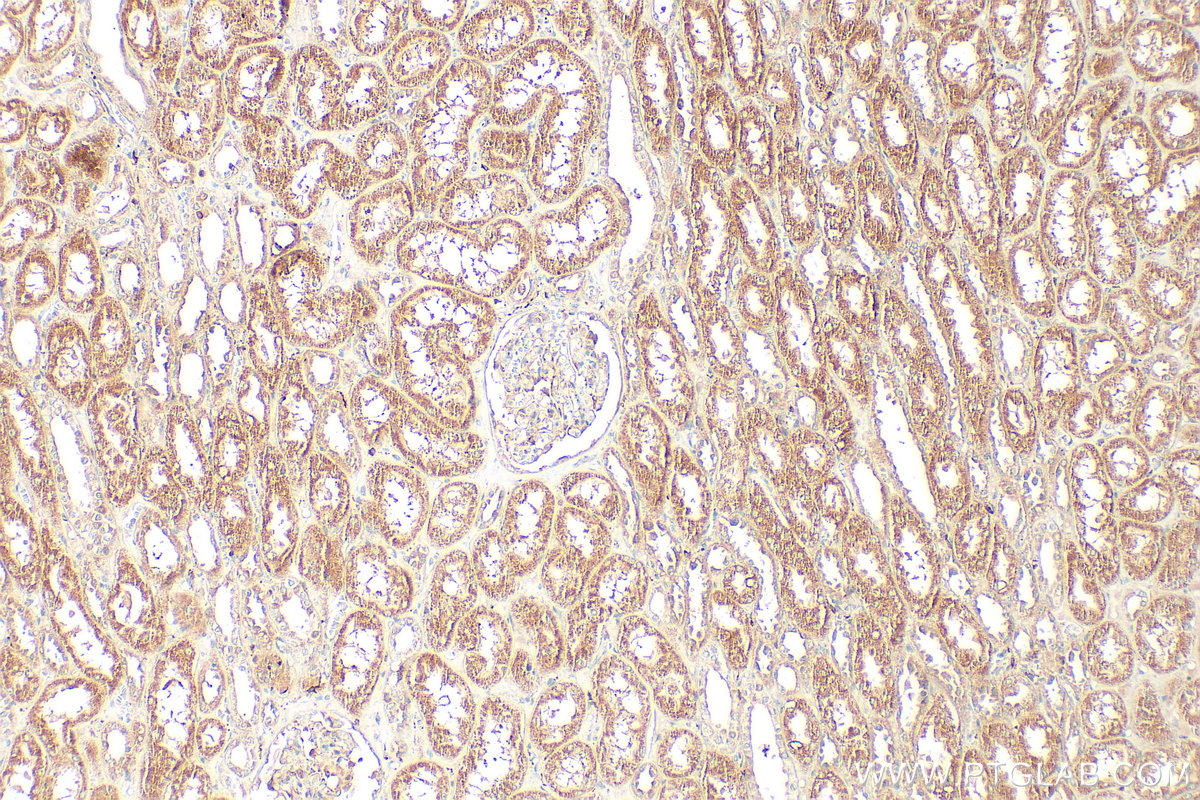 IHC staining of human kidney using 30215-1-AP