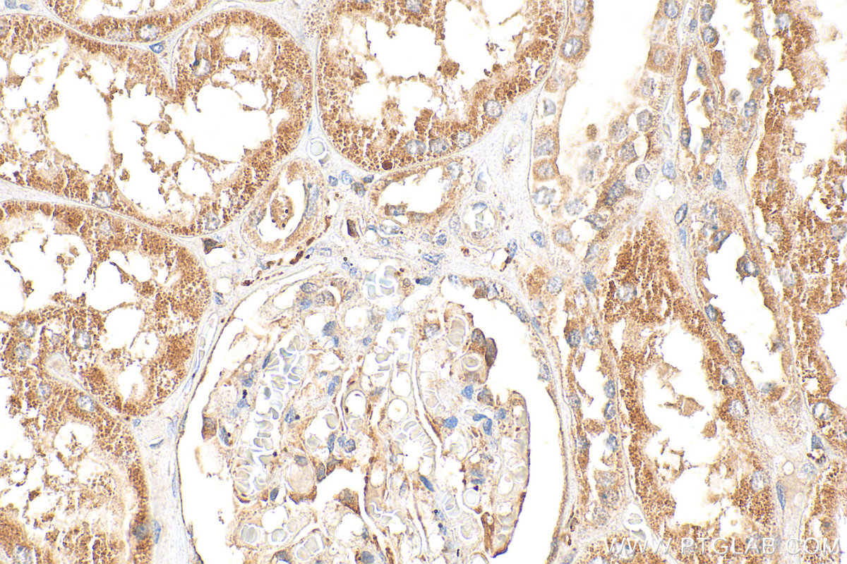 IHC staining of human kidney using 30215-1-AP