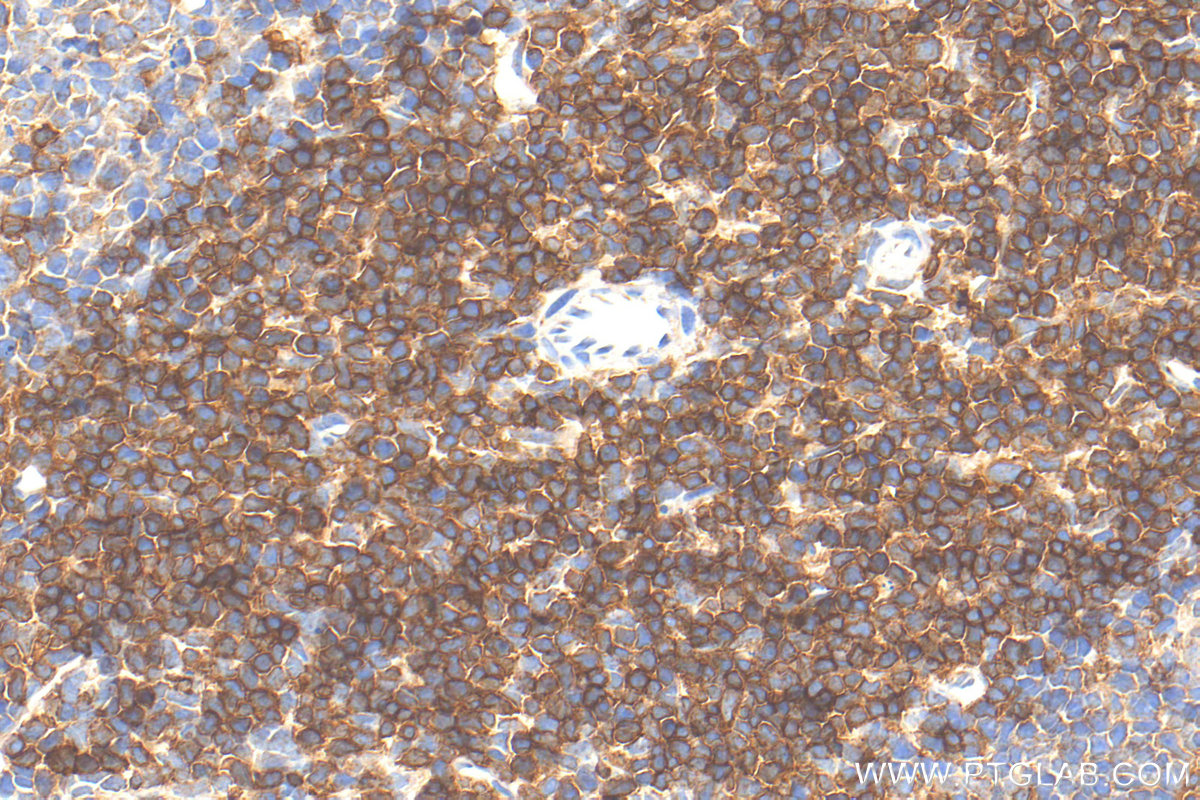 IHC staining of mouse spleen using 32193-1-AP