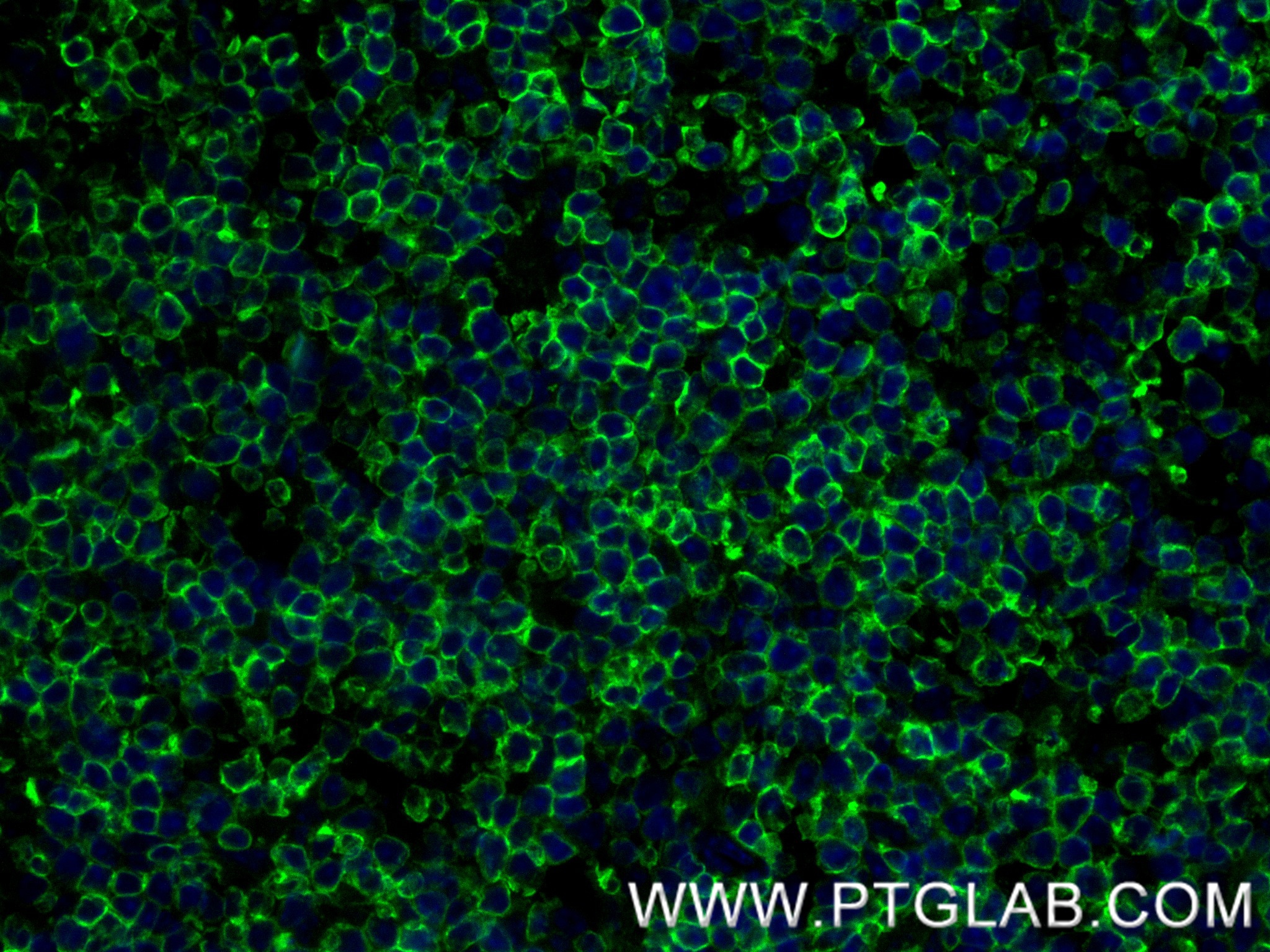 IF Staining of mouse thymus using 84878-5-RR