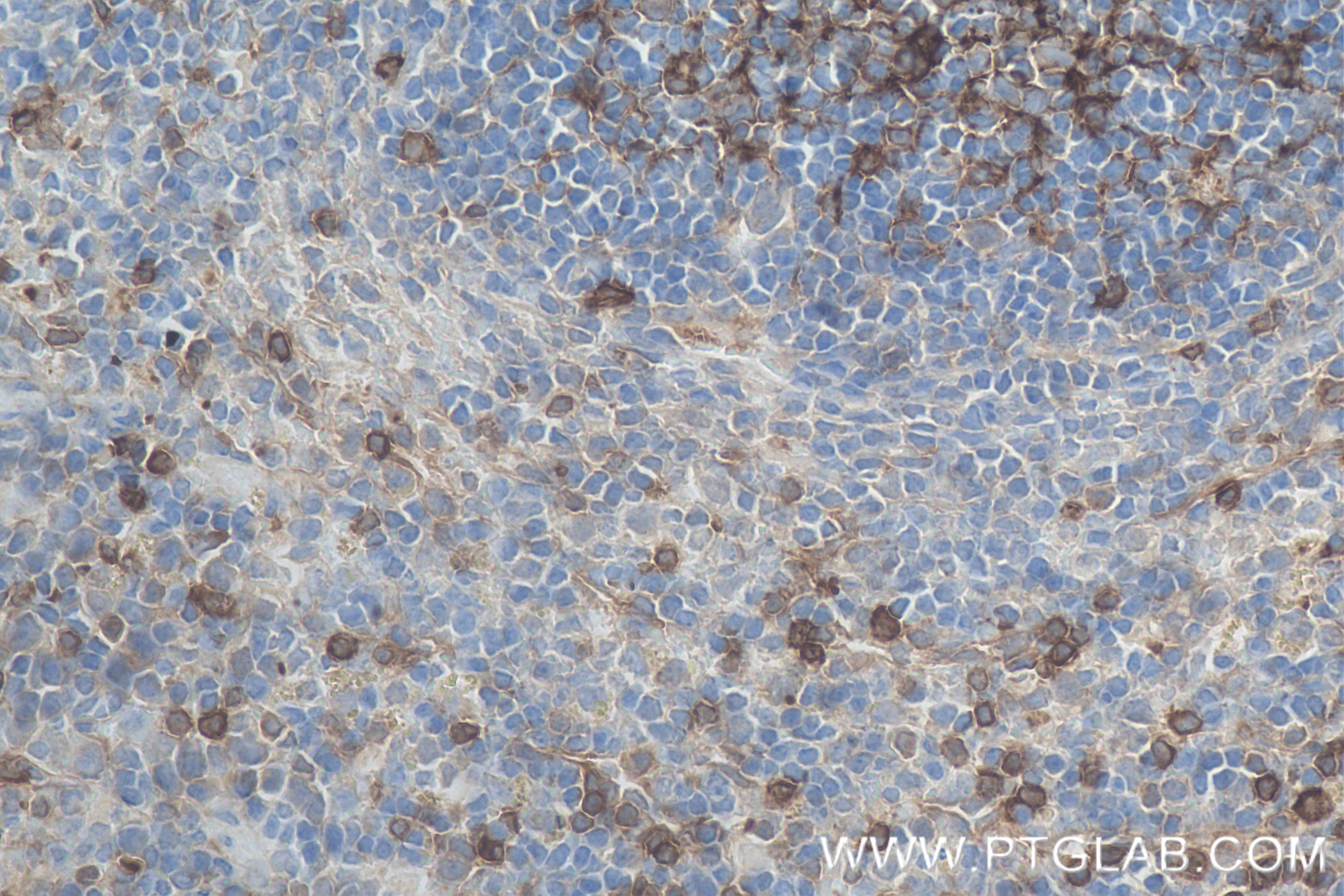 IHC staining of mouse spleen using 84878-5-RR