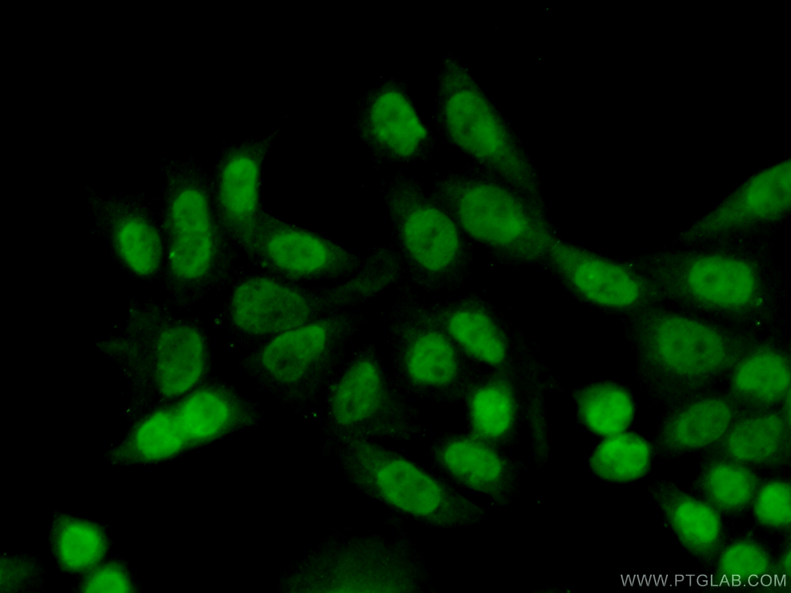 IF Staining of HeLa using 17158-1-AP