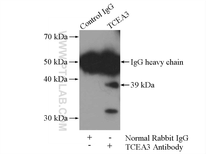 IP experiment of HeLa using 17158-1-AP