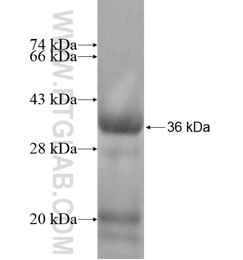 TCEAL2 fusion protein Ag12619 SDS-PAGE TCEAL2 fusion protein Ag12619 SDS-PAGE