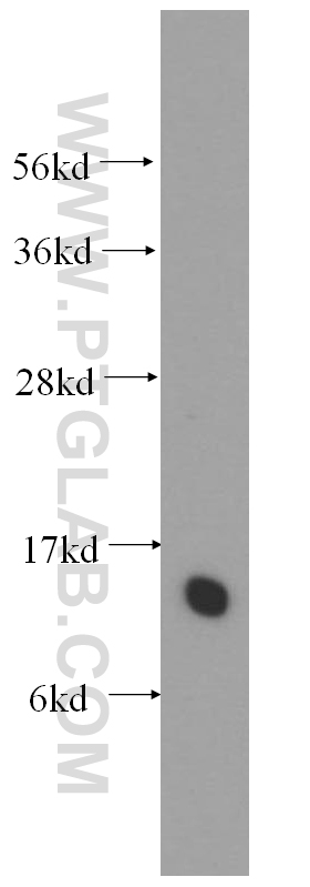 WB analysis of human liver using 11218-1-AP (same clone as 11218-1-PBS)