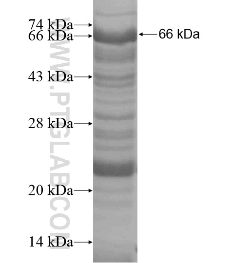 TCEANC fusion protein Ag19202 SDS-PAGE TCEANC fusion protein Ag19202 SDS-PAGE