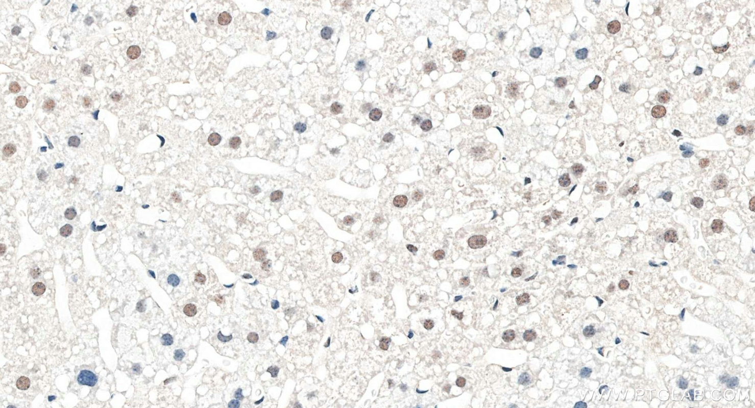 IHC staining of mouse liver using 10502-1-AP IHC staining of mouse liver using 10502-1-AP