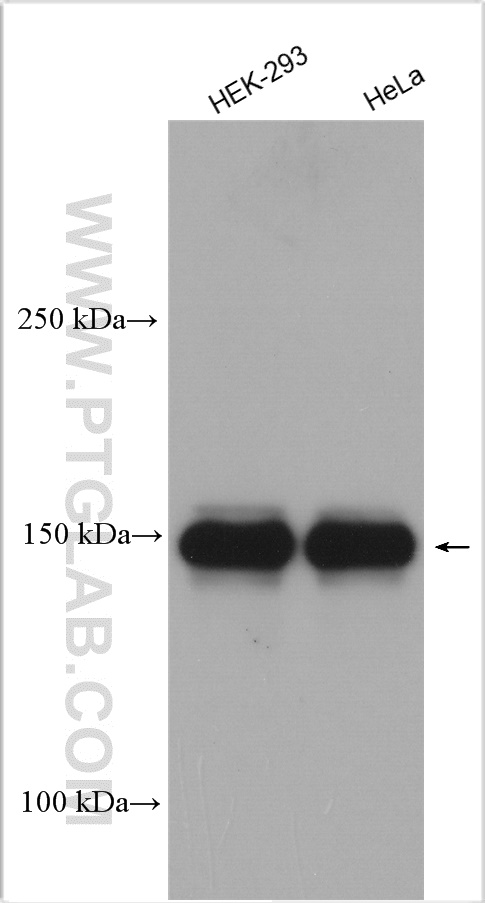 WB analysis using 21858-1-AP