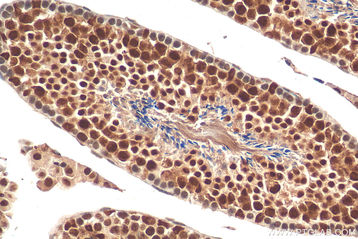 IHC staining of mouse testis using 20858-1-AP (same clone as 20858-1-PBS)