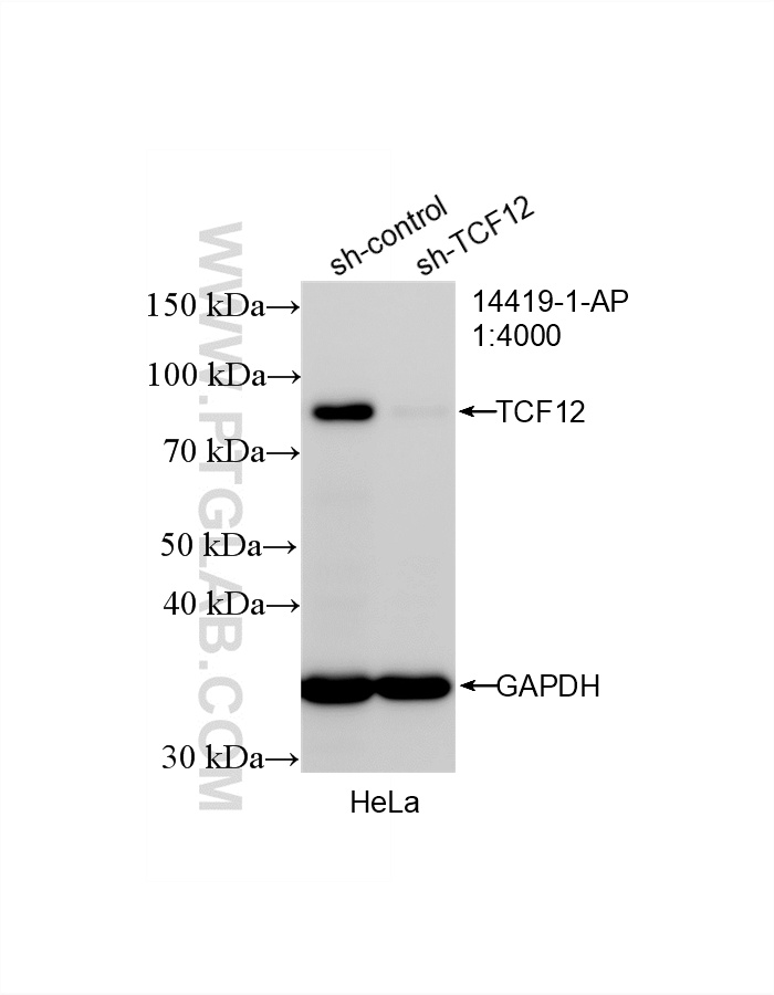 WB result of TCF12/HEB antibody (14419-1-AP; 1:4000; incubated at room temperature for 1.5 hours) with sh-Control and sh-TCF12/HEB transfected HeLa cells. WB analysis of HeLa using 14419-1-AP