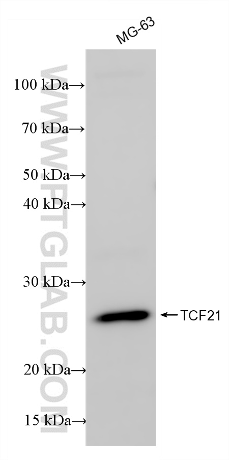 Various lysates were subjected to SDS PAGE followed by western blot with 86294-2-RR (TCF21 antibody) at dilution of 1:10000 incubated at room temperature for 1.5 hours. WB analysis using 86294-2-RR