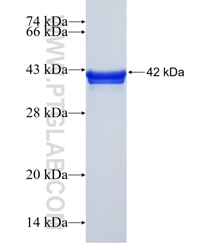TCF21 fusion protein Ag32510 SDS-PAGE