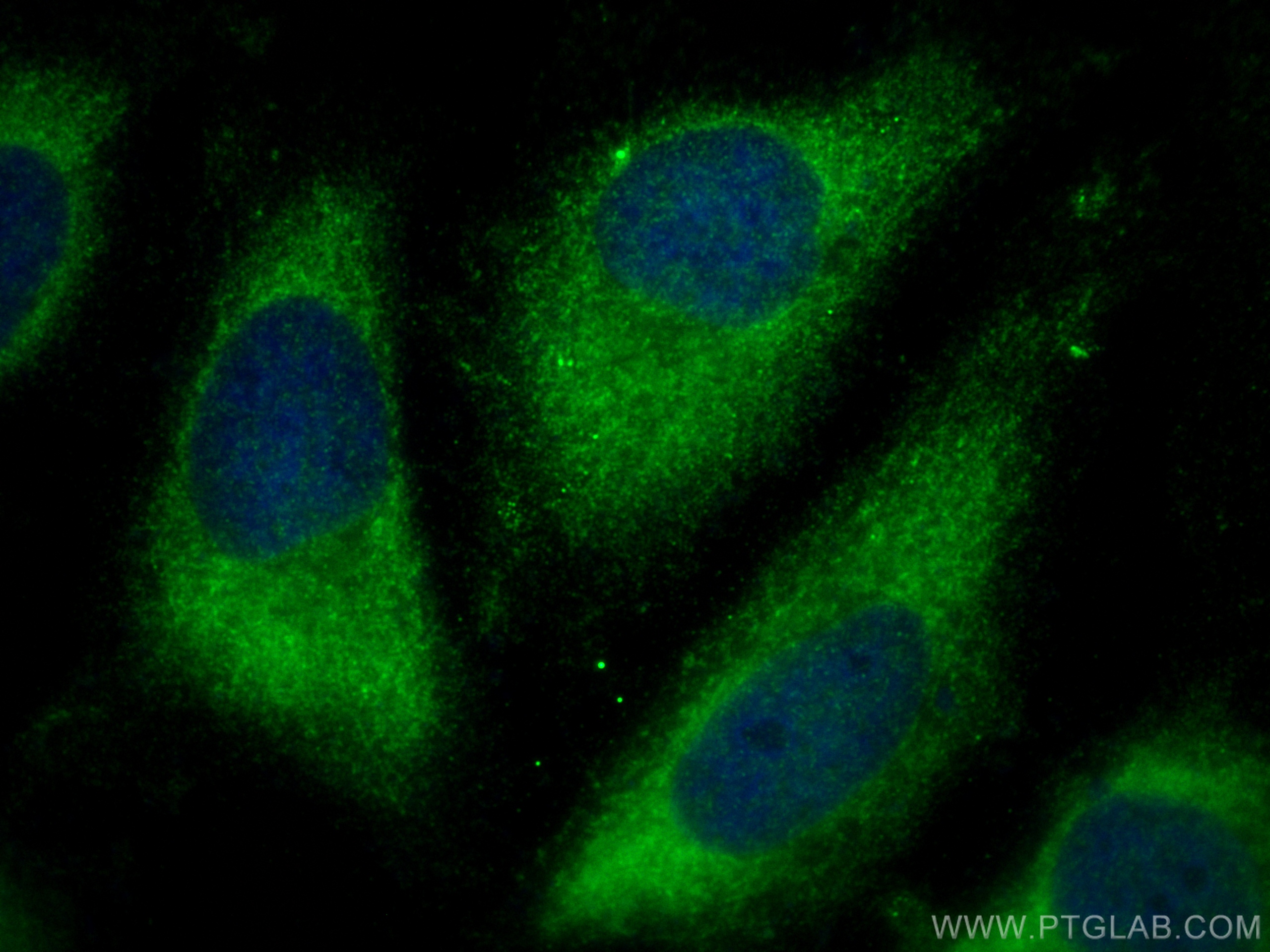 IF Staining of HeLa using 30852-1-AP