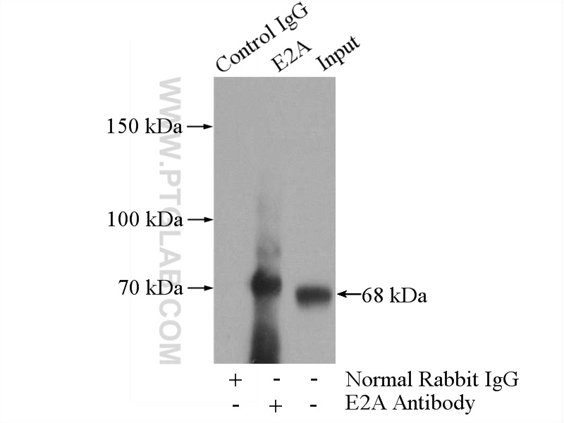 IP experiment of Jurkat using 21242-1-AP