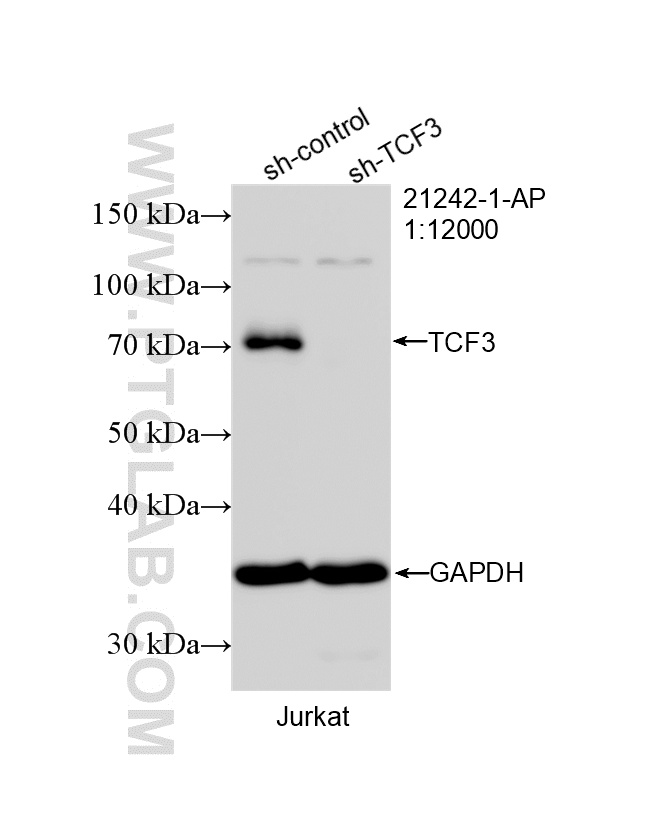 WB analysis of Jurkat using 21242-1-AP