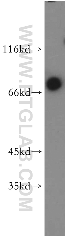 E2A Polyclonal antibody