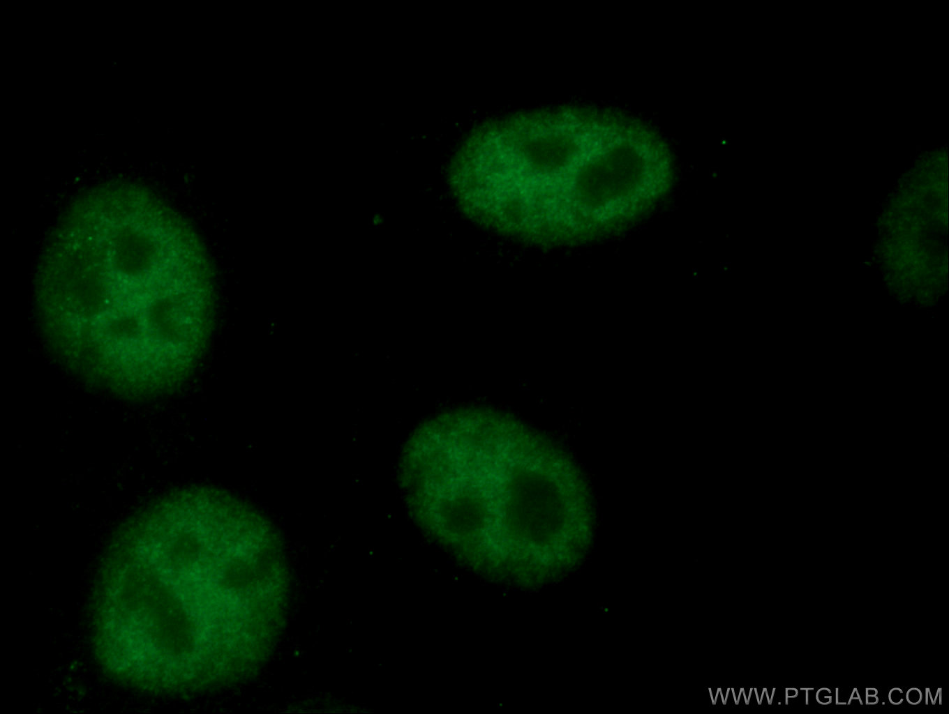 IF Staining of HepG2 using 67140-1-Ig (same clone as 67140-1-PBS)