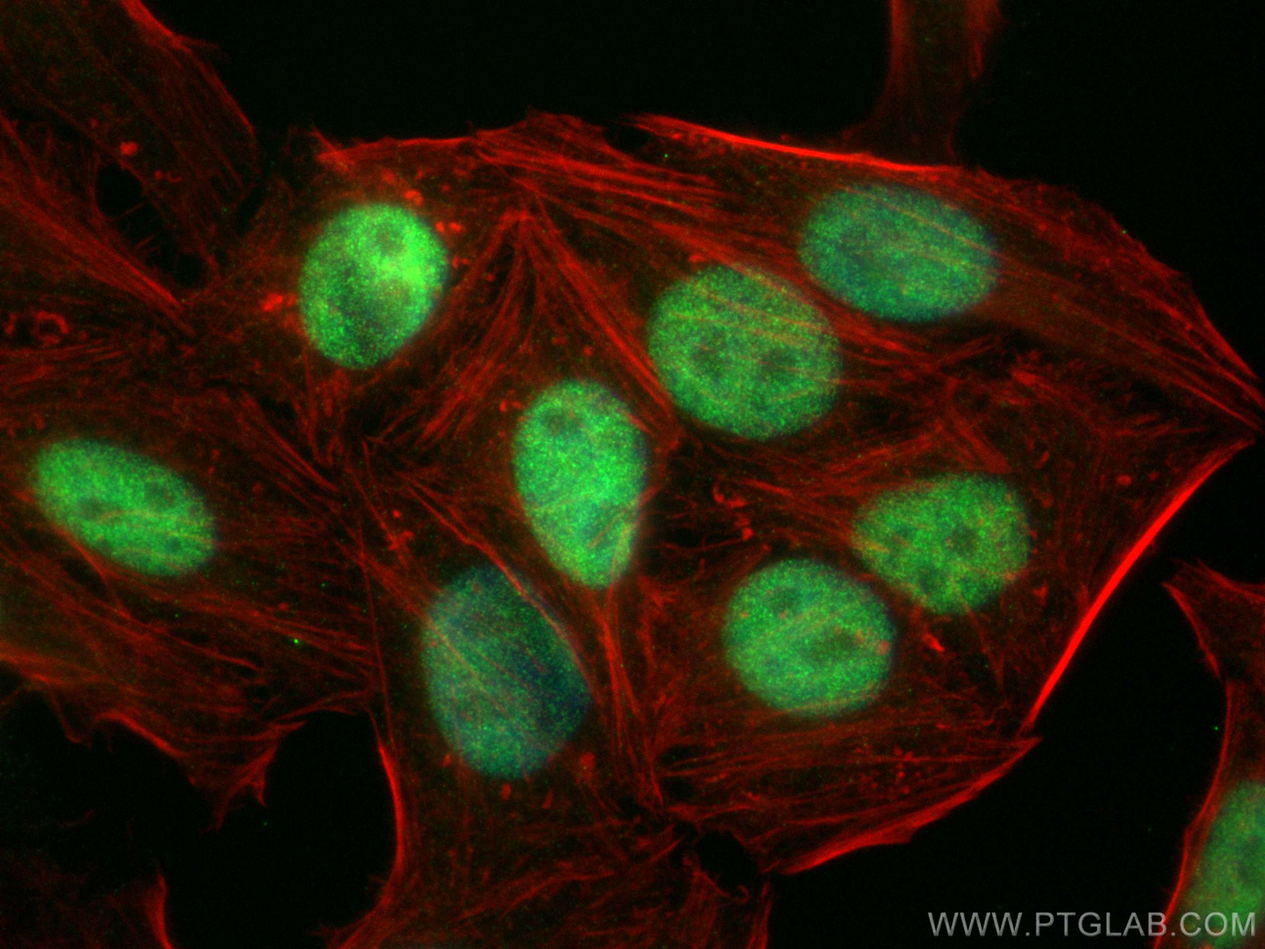 IF Staining of HepG2 using 67140-1-Ig (same clone as 67140-1-PBS)