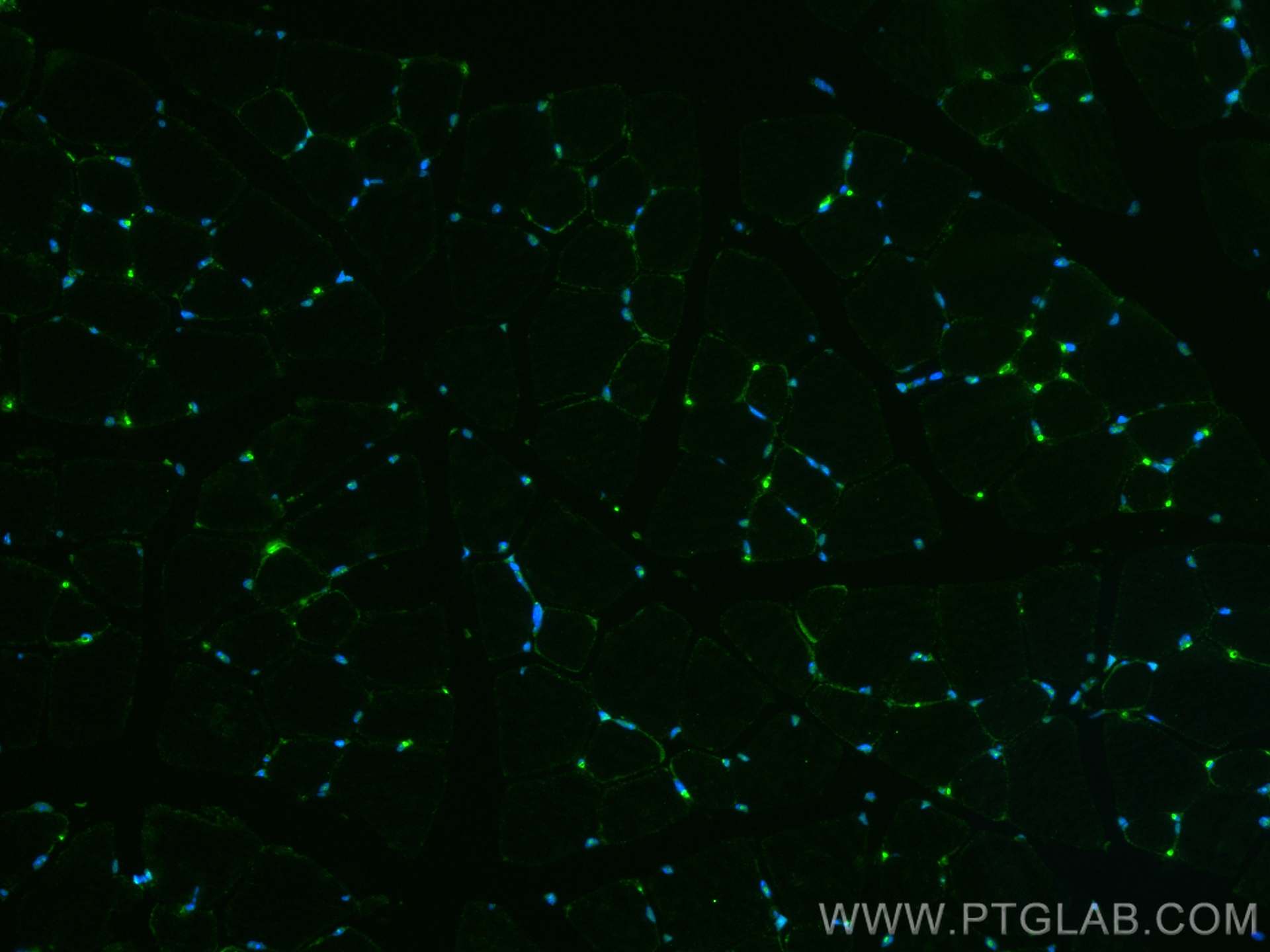 IF Staining of mouse skeletal muscle using 22337-1-AP