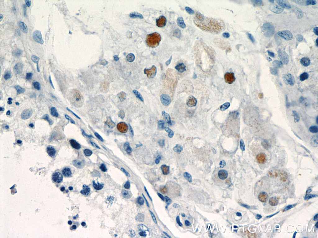 IHC staining of human testis using 22337-1-AP