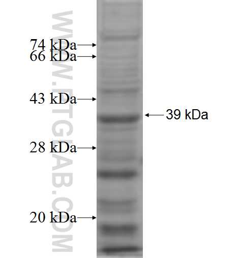 TCF4 fusion protein Ag5672 SDS-PAGE TCF4 fusion protein Ag5672 SDS-PAGE