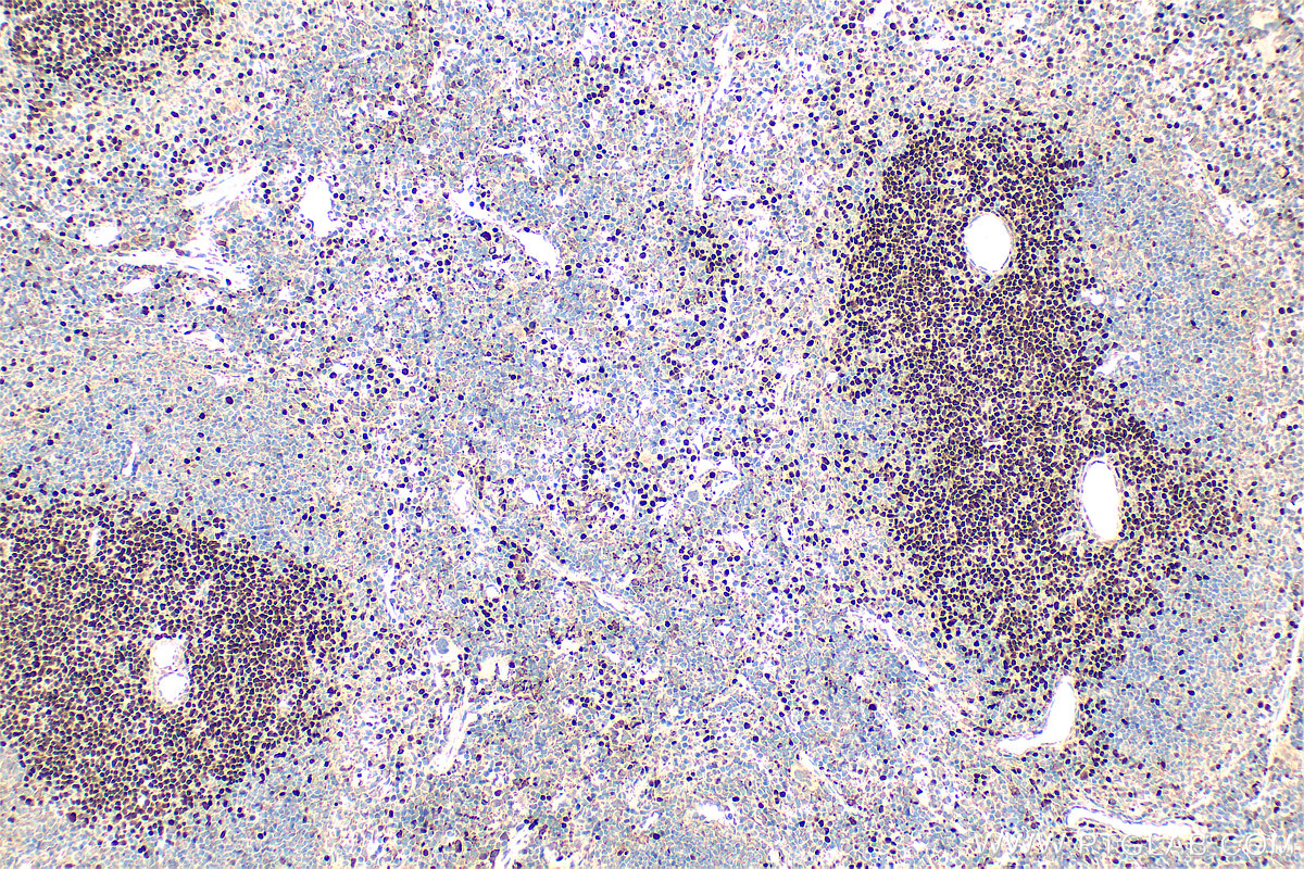 IHC staining of mouse spleen using 14464-1-AP