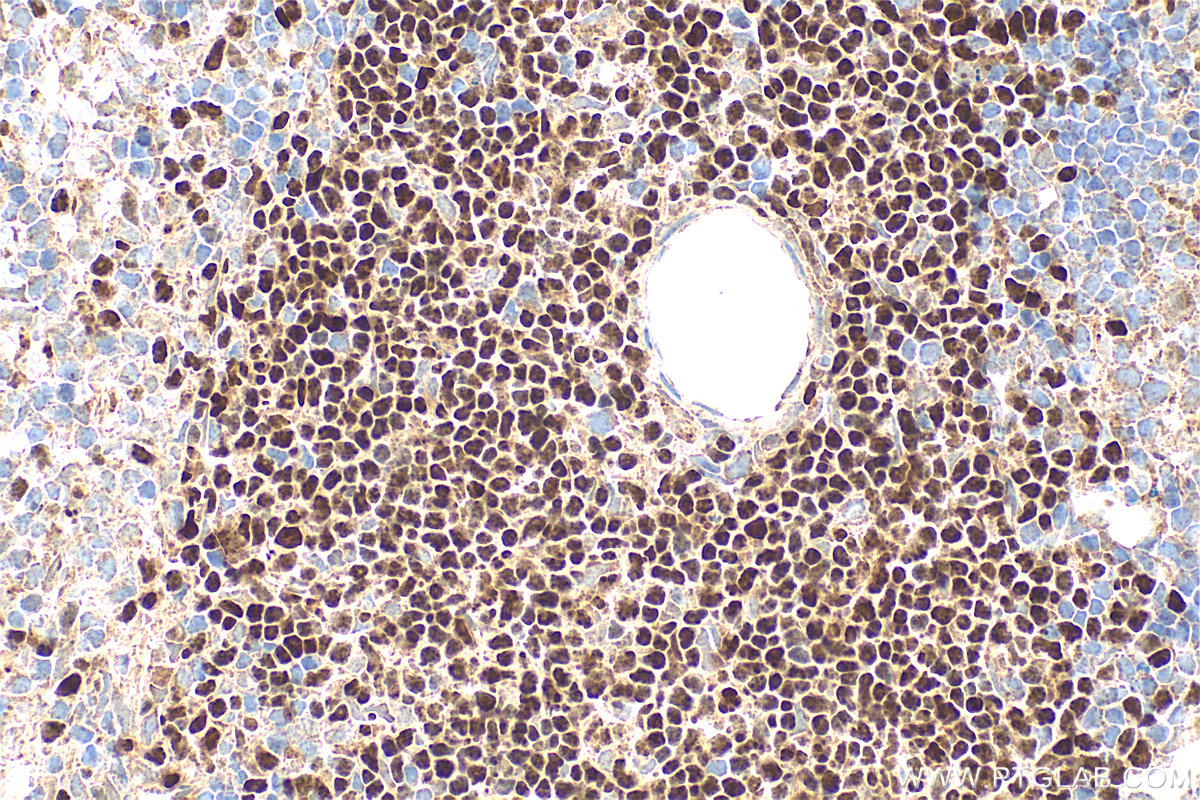 IHC staining of mouse spleen using 14464-1-AP