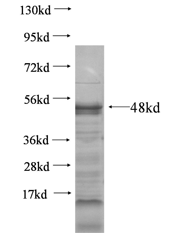 TCF7 fusion protein Ag5989 SDS-PAGE TCF7 fusion protein Ag5989 SDS-PAGE