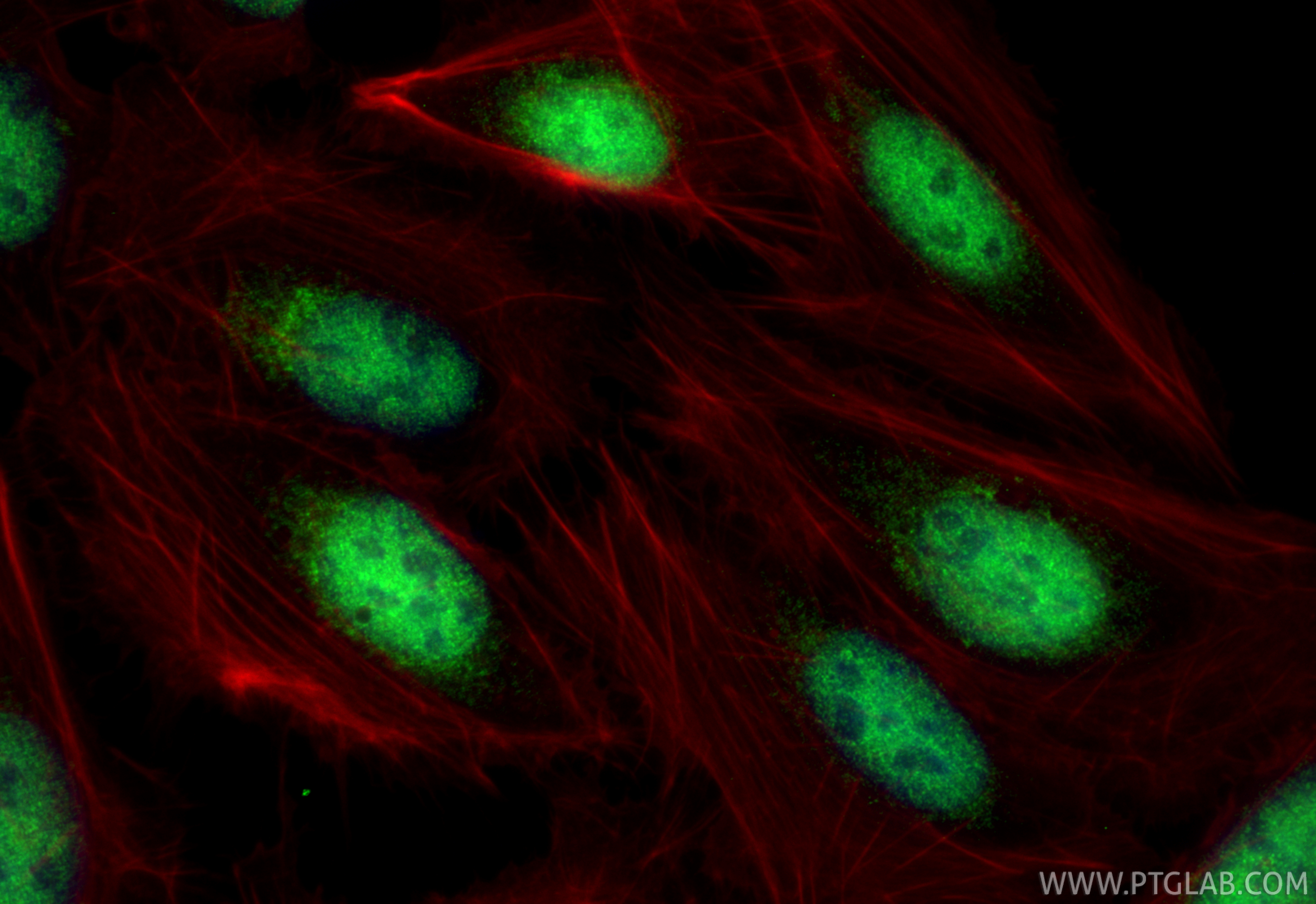 IF Staining of U2OS using 14519-1-AP IF Staining of U2OS using 14519-1-AP