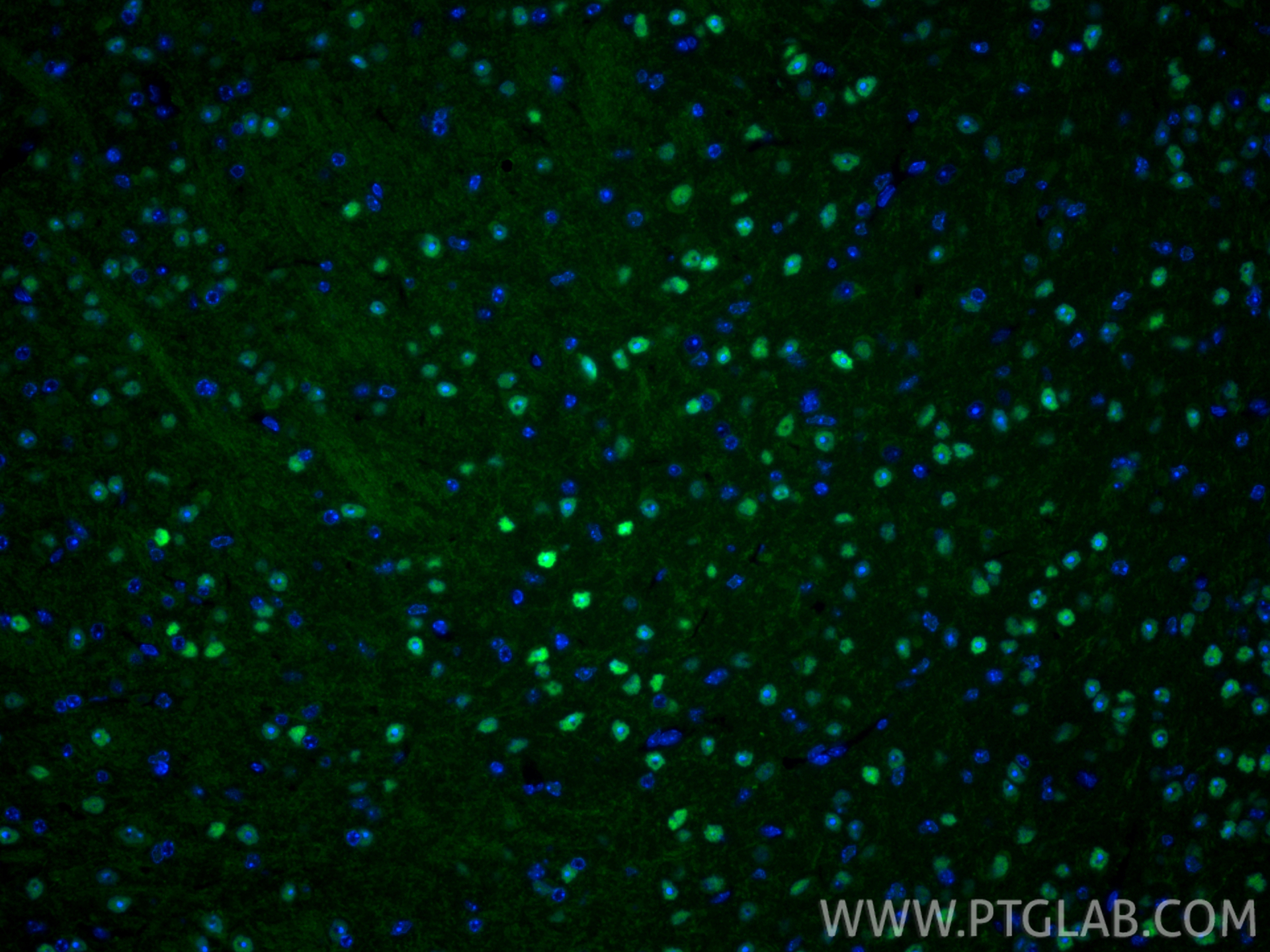 IF Staining of mouse brain using 83588-3-RR (same clone as 83588-3-PBS)