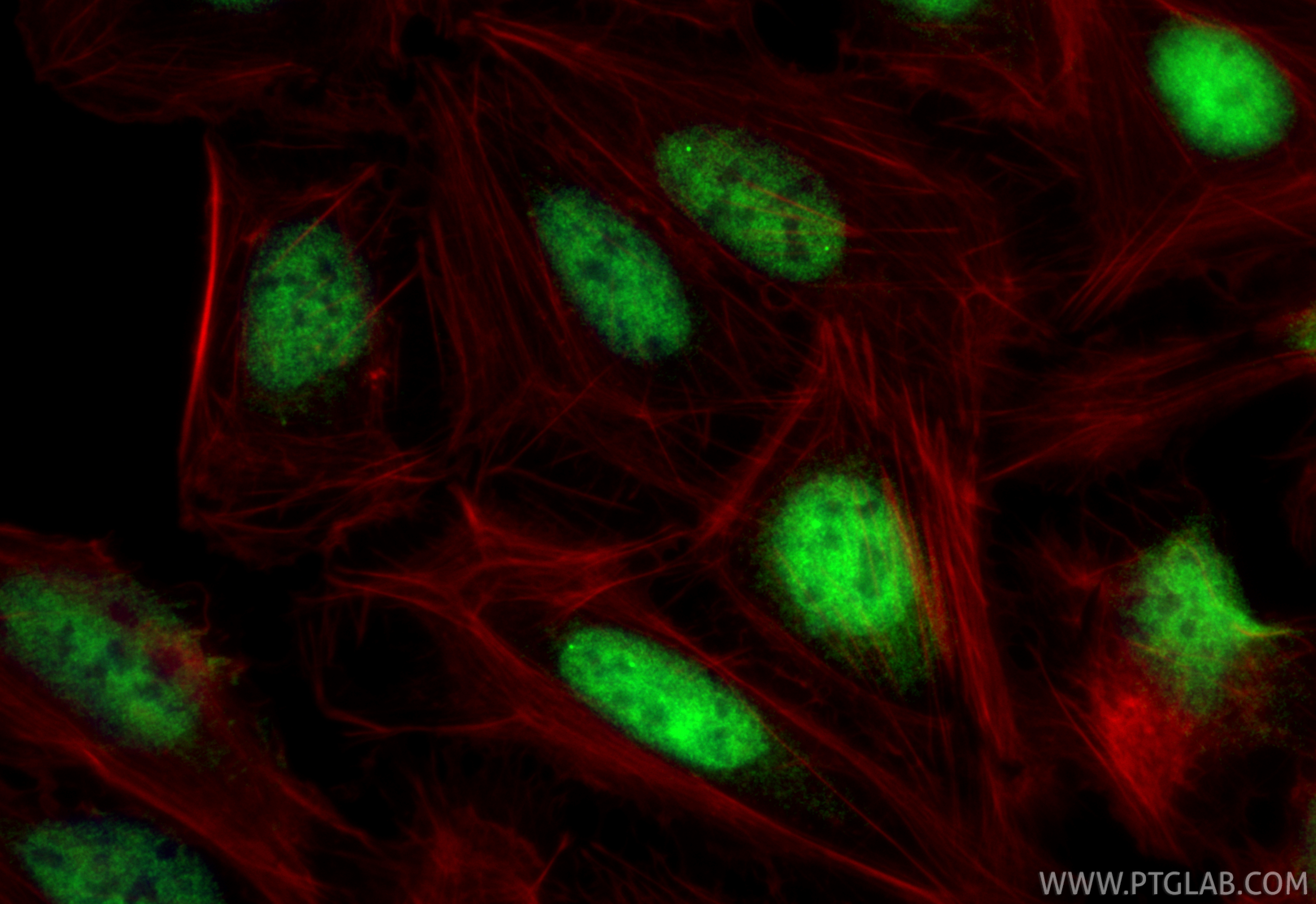 IF Staining of U2OS using 83588-3-RR (same clone as 83588-3-PBS)