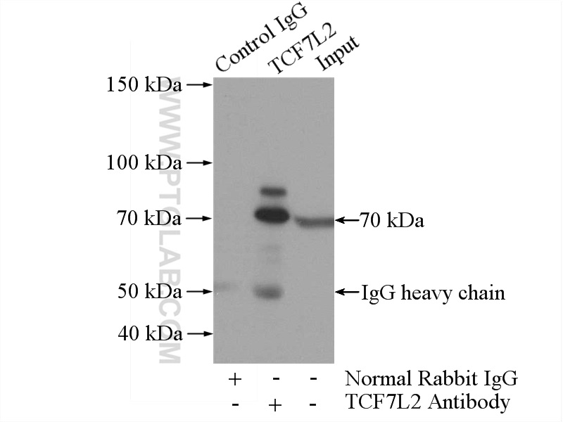 IP experiment of mouse liver using 13838-1-AP