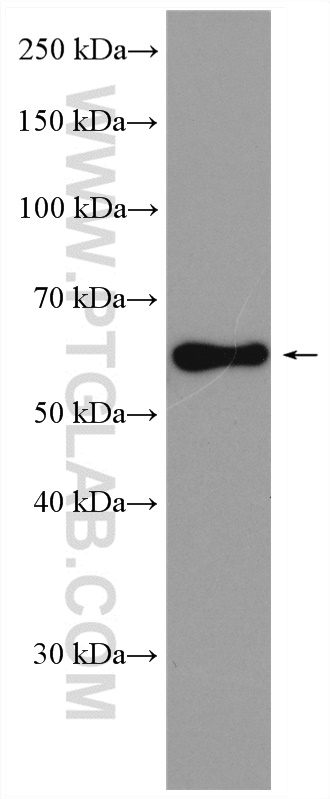 WB analysis of mouse testis using 29404-1-AP