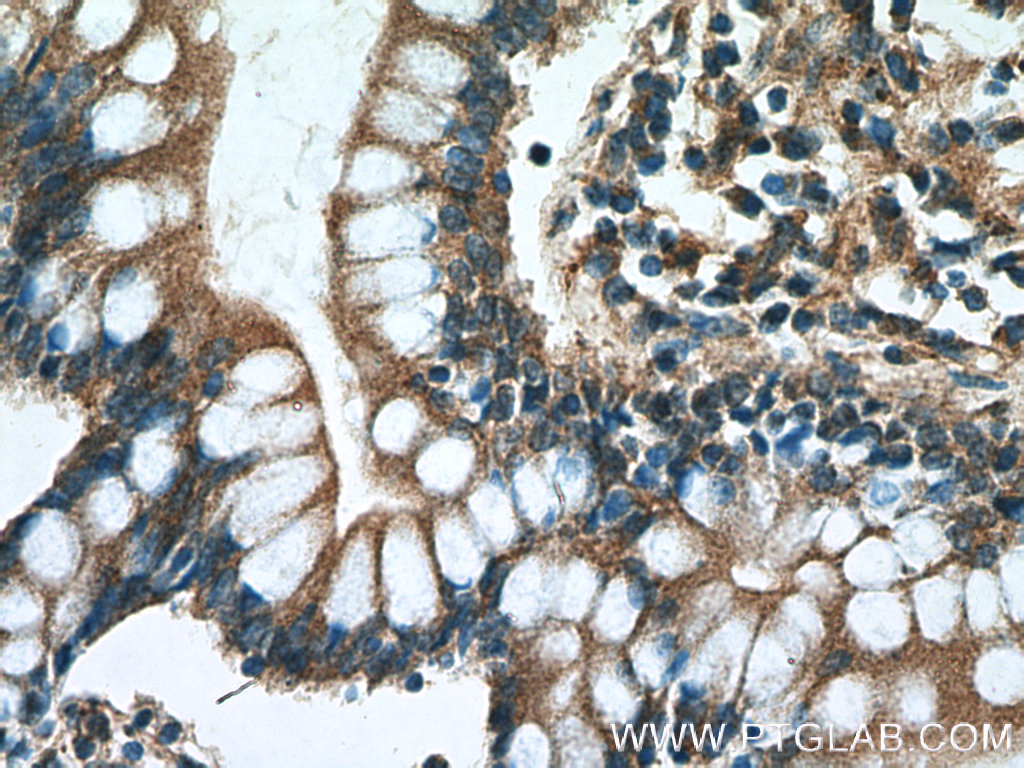 IHC staining of human small intestine using 25931-1-AP