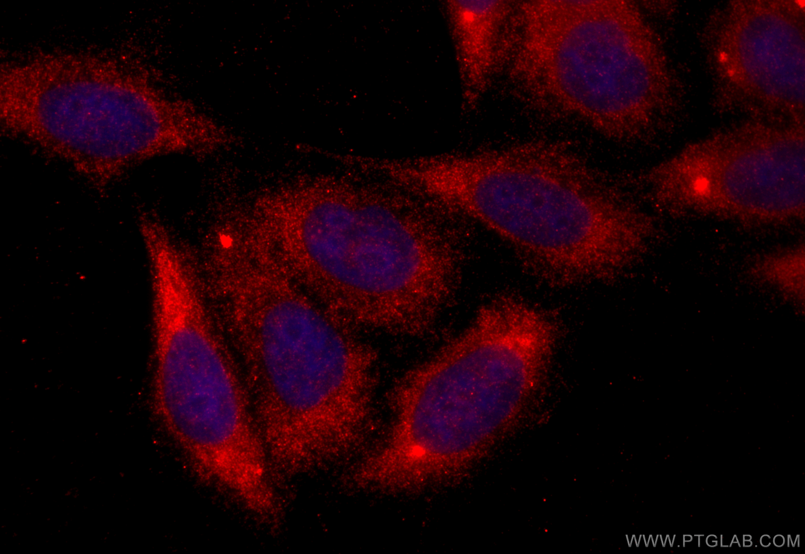 IF Staining of HepG2 using 12649-1-AP
