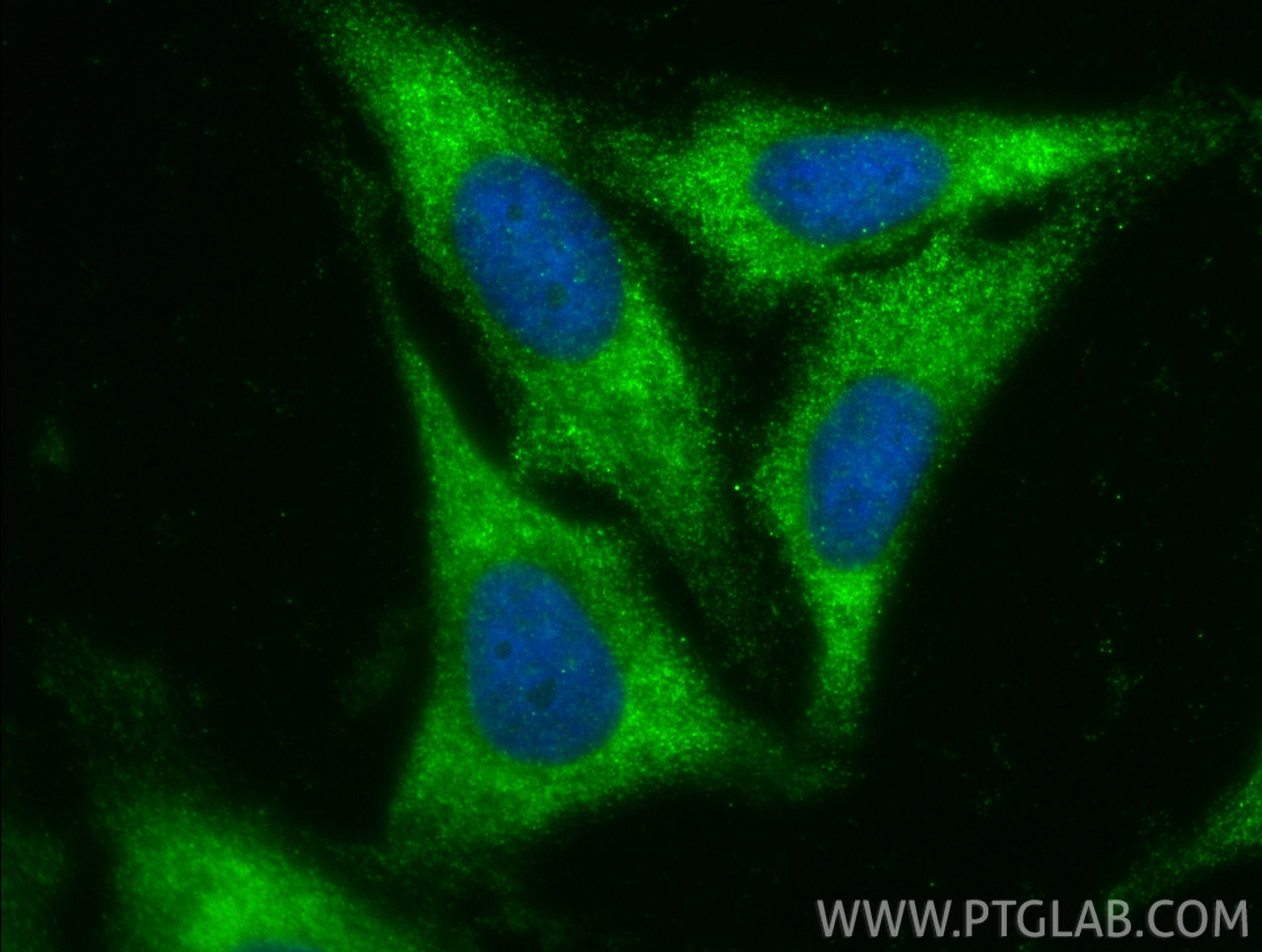IF Staining of HepG2 using 12649-1-AP (same clone as 12649-1-PBS) IF Staining of HepG2 using 12649-1-AP (same clone as 12649-1-PBS)