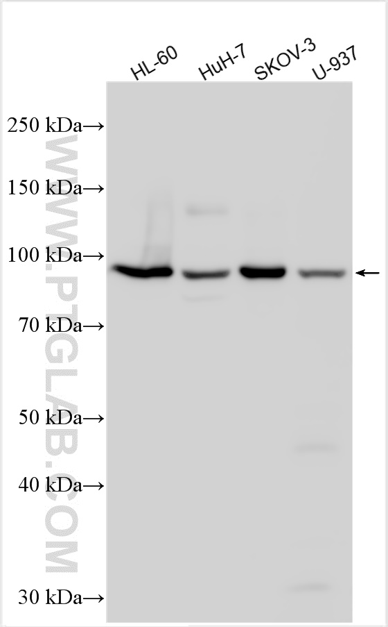 WB analysis using 12649-1-AP