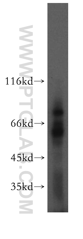 TCIRG1