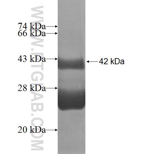 TCL6 fusion protein Ag9848 SDS-PAGE TCL6 fusion protein Ag9848 SDS-PAGE