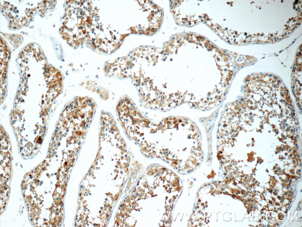 IHC staining of human testis using 16078-1-AP