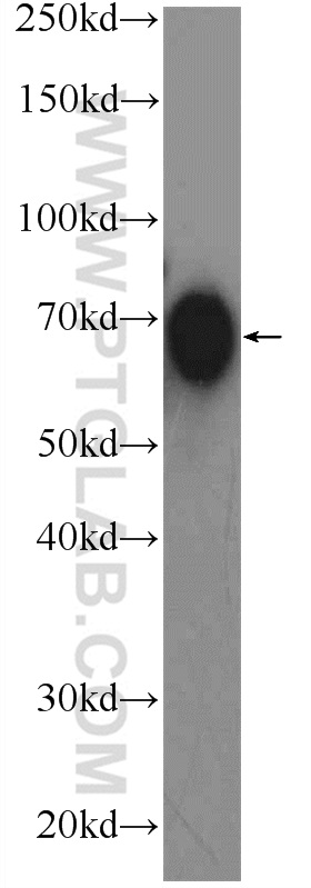 TCN1 Polyclonal antibody