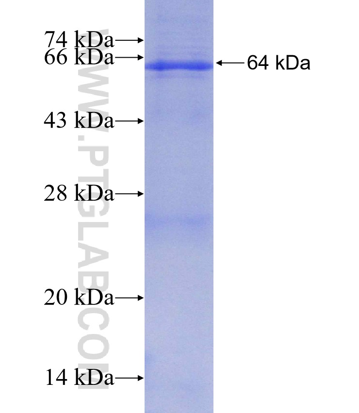 TCN2 fusion protein Ag2825 SDS-PAGE