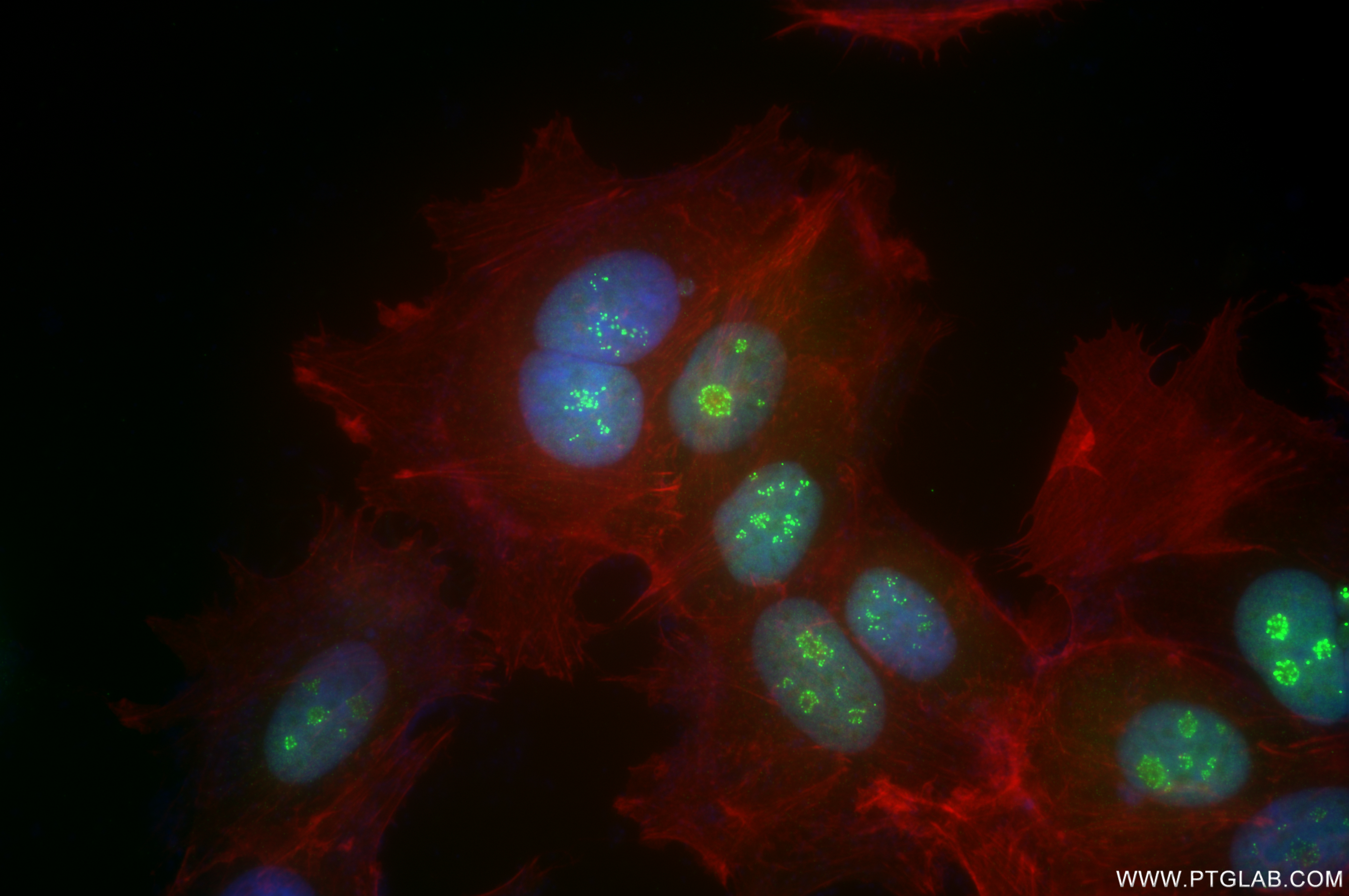 IF Staining of MCF-7 using 84914-4-RR