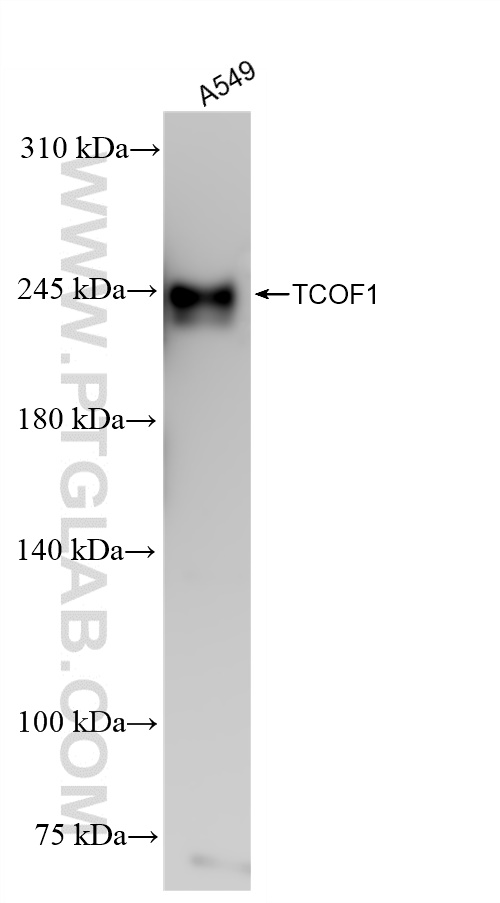 WB analysis of A549 using 84914-4-RR