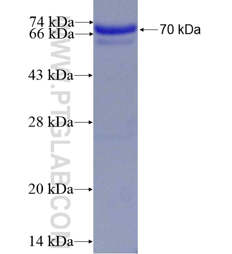 TCOF1 fusion protein Ag1447 SDS-PAGE