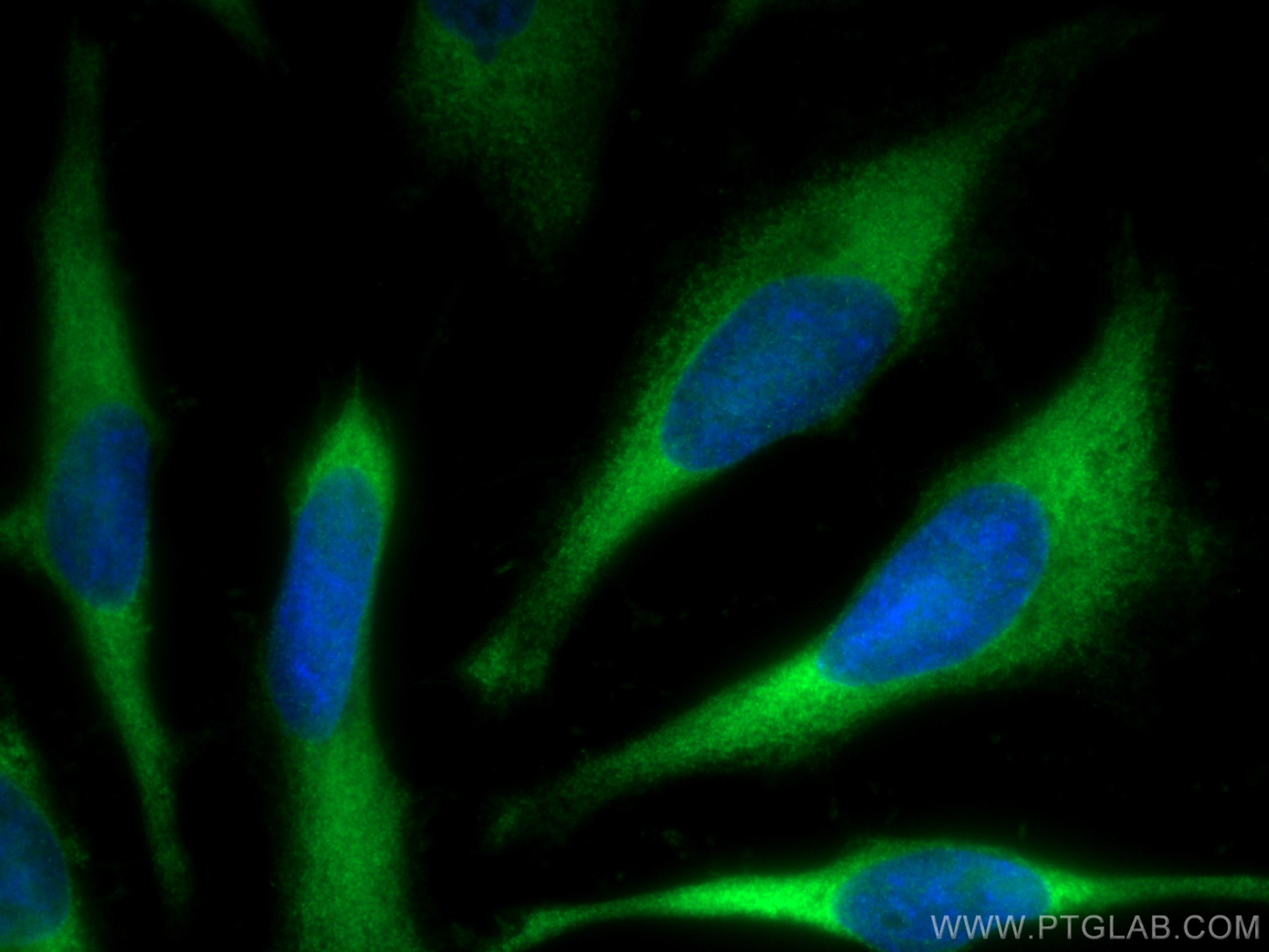 IF Staining of HeLa using 10320-1-AP