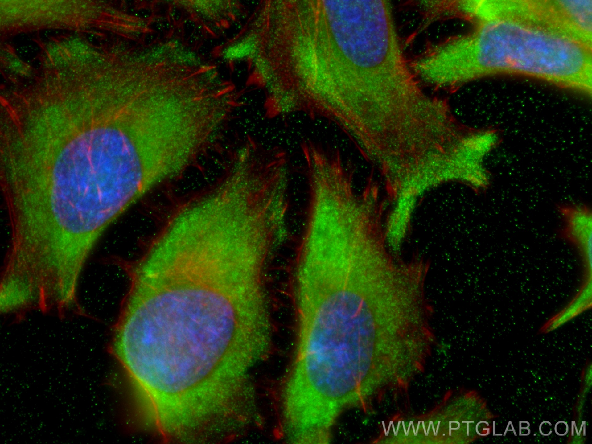 IF Staining of HeLa using 68183-1-Ig