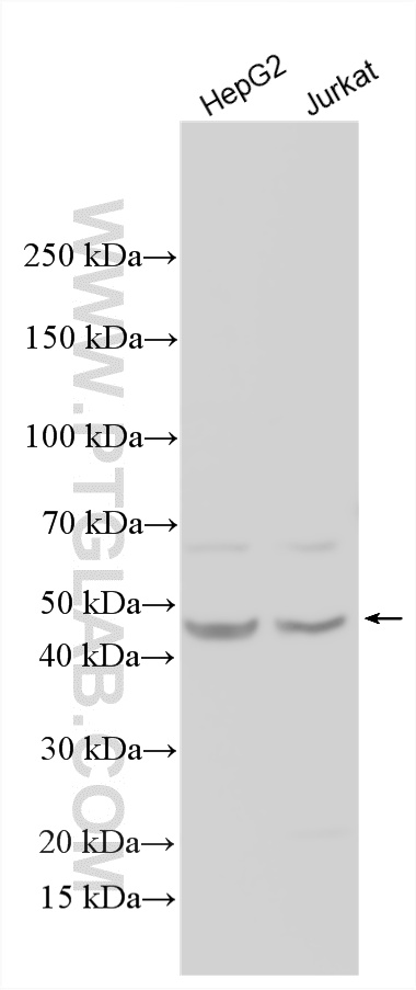 WB analysis using 14538-1-AP WB analysis using 14538-1-AP